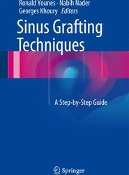 Sinus Grafting Techniques