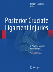 Posterior Cruciate Ligament Injuries