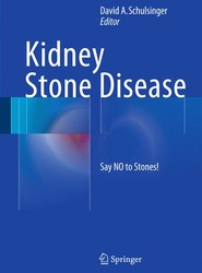Kidney Stone Disease