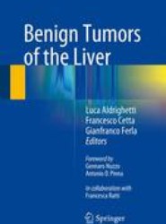 Benign Tumors of the Liver