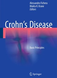 Crohn's Disease