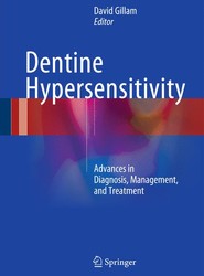 Dentine Hypersensitivity