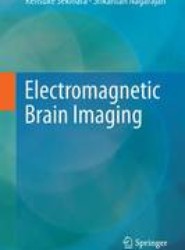 Electromagnetic Brain Imaging