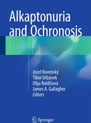 Alkaptonuria and Ochronosis