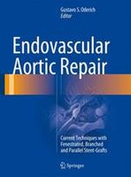 Endovascular Aortic Repair