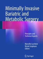 Minimally Invasive Bariatric and Metabolic Surgery