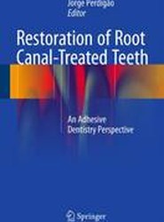 Restoration of Root Canal-Treated Teeth