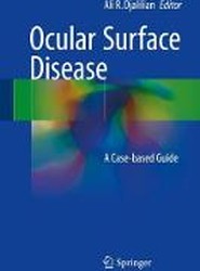 Ocular Surface Disease