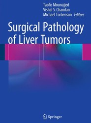 Surgical Pathology of Liver Tumors