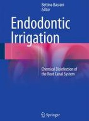 Endodontic Irrigation