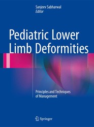 Pediatric Lower Limb Deformities