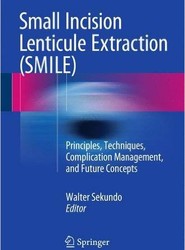 Small Incision Lenticule Extraction (SMILE)