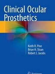 Clinical Ocular Prosthetics