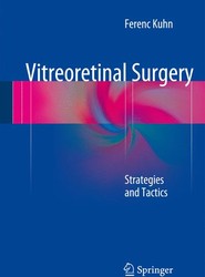 Vitreoretinal Surgery: Strategies and Tactics