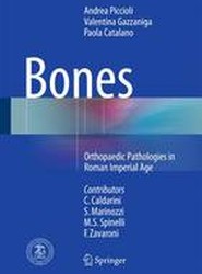 Bones