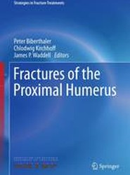 Fractures of the Proximal Humerus