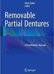 Removable Partial Dentures