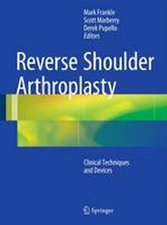 Reverse Shoulder Arthroplasty