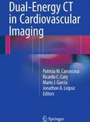 Dual-Energy CT in Cardiovascular Imaging