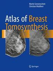 Atlas of Breast Tomosynthesis