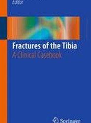 Fractures of the Tibia
