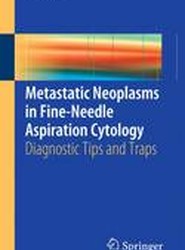Metastatic Neoplasms in Fine-Needle Aspiration Cytology