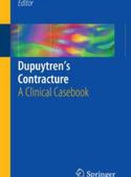 Dupuytren's Contracture