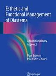 Esthetic and Functional Management of Diastema