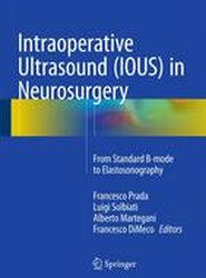 Intraoperative Ultrasound (IOUS) in Neurosurgery