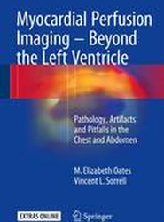 Myocardial Perfusion Imaging - Beyond the Left Ventricle