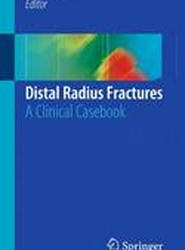 Distal Radius Fractures
