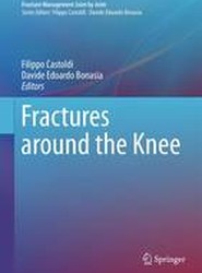 Fractures Around the Knee