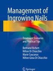 Management of Ingrowing Nails