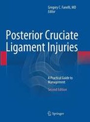 Posterior Cruciate Ligament Injuries