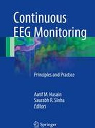 Continuous EEG Monitoring