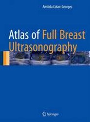 Atlas of Full Breast Ultrasonography
