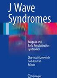 J Wave Syndromes