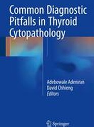 Common Diagnostic Pitfalls in Thyroid Cytopathology