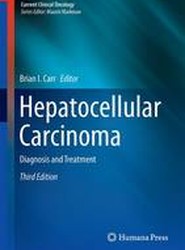 Hepatocellular Carcinoma