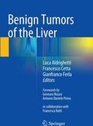 Benign Tumors of the Liver