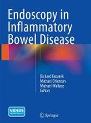 Endoscopy in Inflammatory Bowel Disease