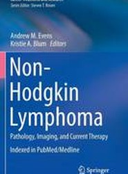 Non-Hodgkin Lymphoma