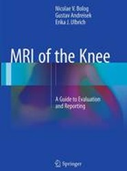 MRI of the Knee