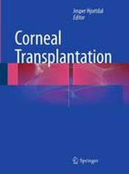 Corneal Transplantation