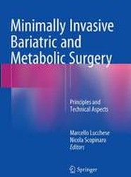 Minimally Invasive Bariatric and Metabolic Surgery