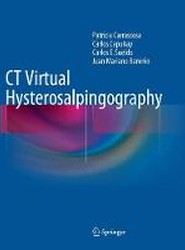 CT Virtual Hysterosalpingography