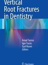 Vertical Root Fractures in Dentistry