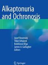 Alkaptonuria and Ochronosis