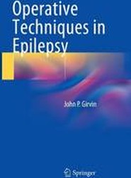 Operative Techniques in Epilepsy