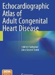 Echocardiographic Atlas of Adult Congenital Heart Disease